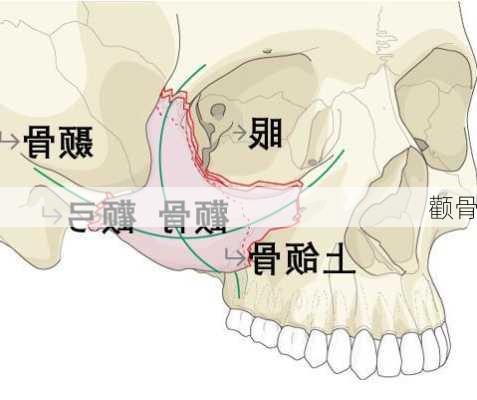 颧骨