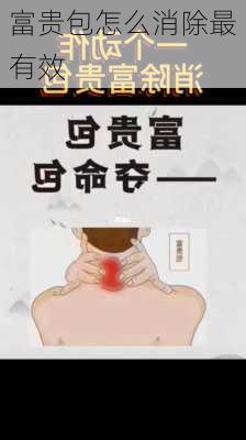 富贵包怎么消除最有效